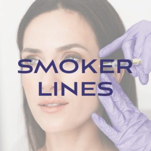 Filler: Smoker Lines